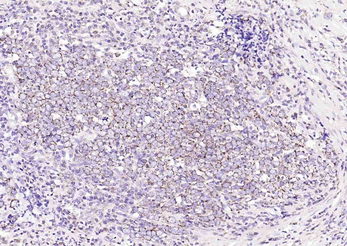 Anti-DIO2 Polyclonal Antibody