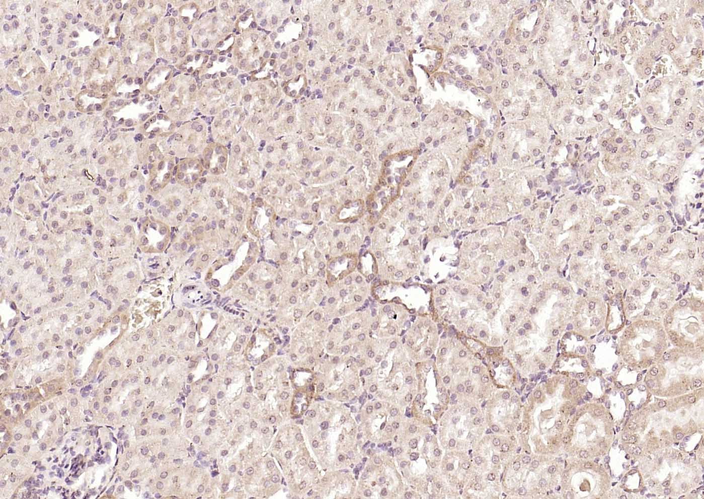 Anti-DLST Polyclonal Antibody