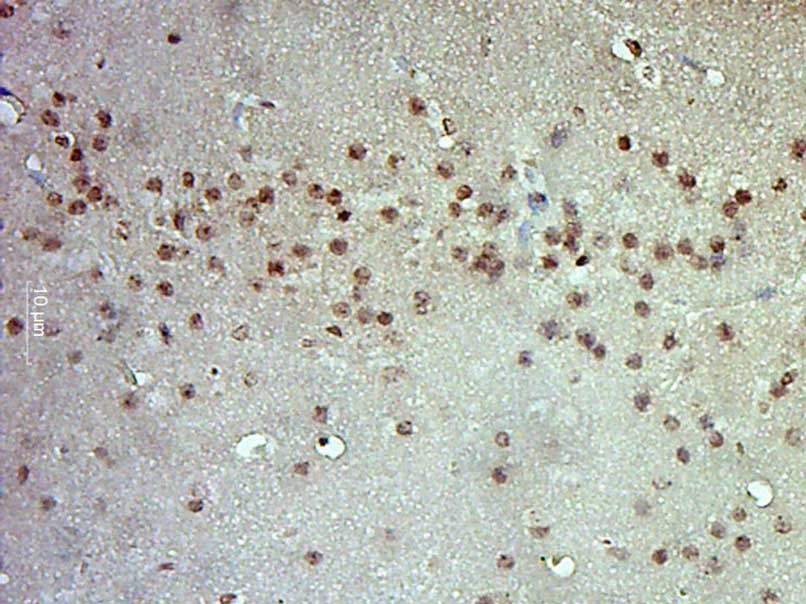 Anti-ERK1/2 Polyclonal Antibody