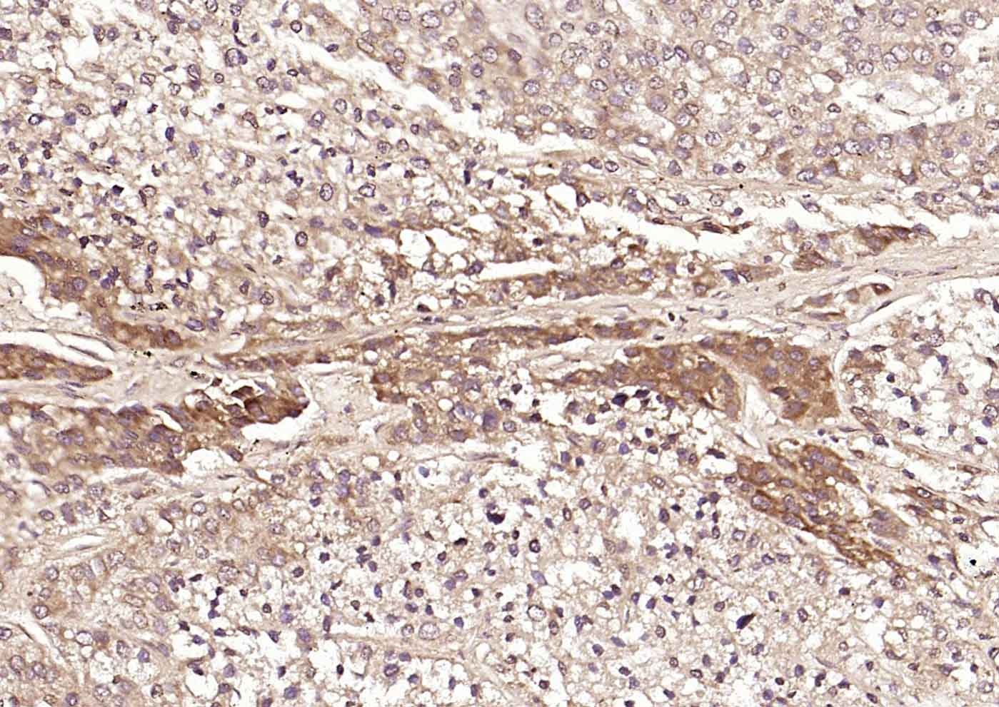 Anti-DLST Polyclonal Antibody