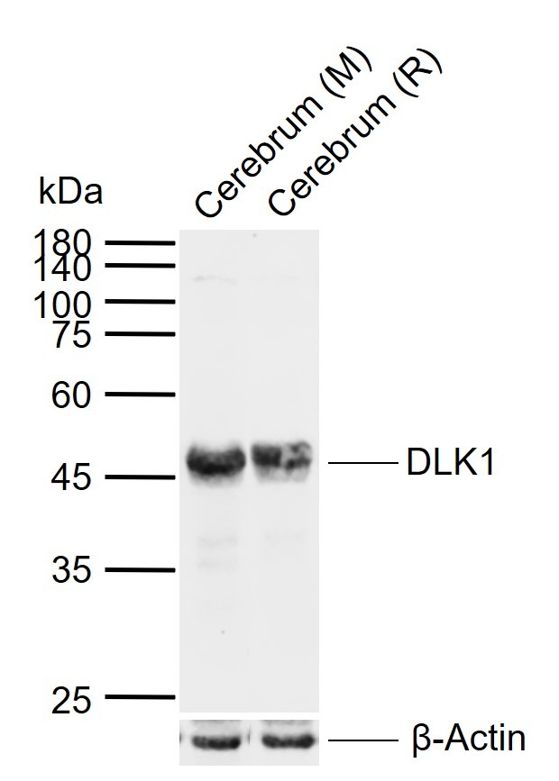 Anti-DLK1 Polyclonal Antibody