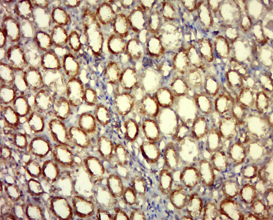 Anti-FA83D Polyclonal Antibody
