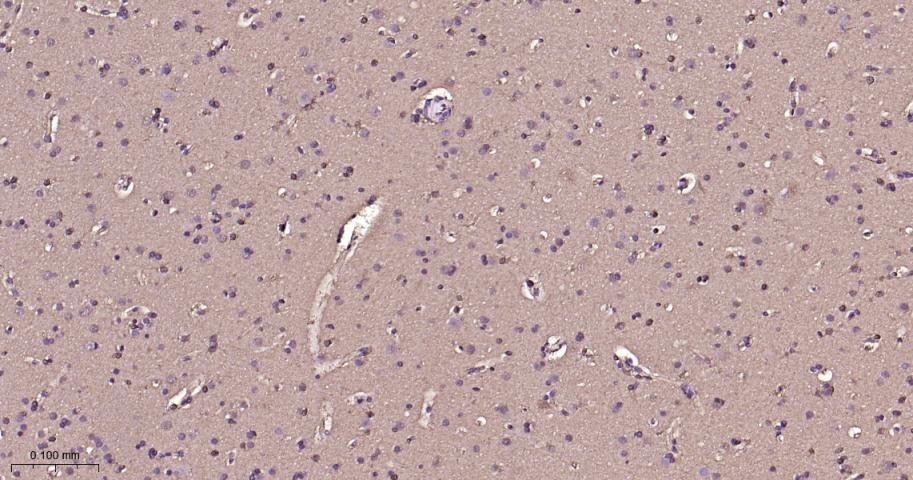 Anti-ERK1/2 Antibody (6Q27)