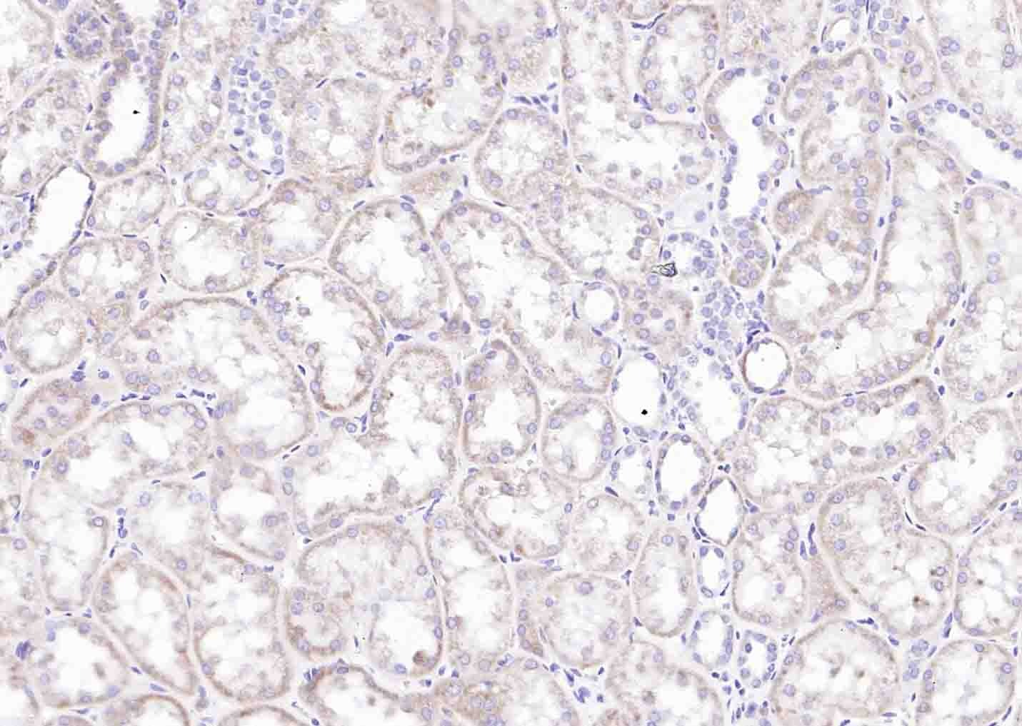 Anti-CYR61/CCN1 Polyclonal Antibody