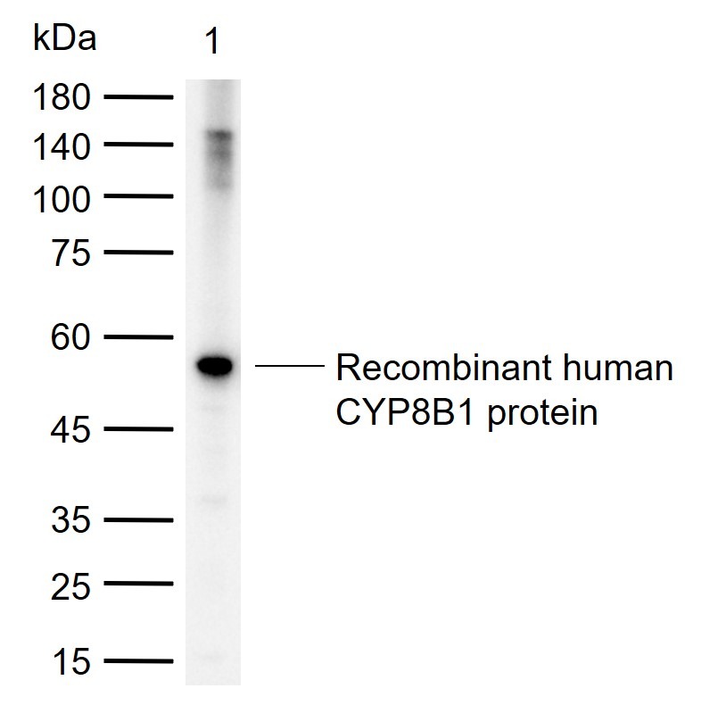 Anti-CYP8B1 Polyclonal Antibody