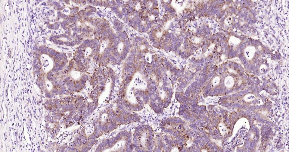Anti-CYCS Antibody (3R796)