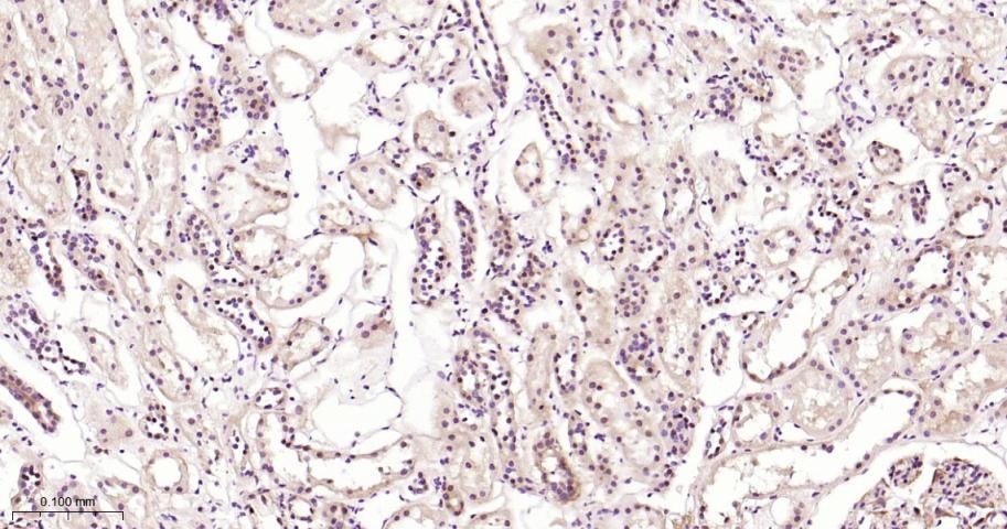 Anti-ERK1/2 Antibody (6Q27)