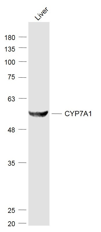 Anti-CYP7A1 Polyclonal Antibody