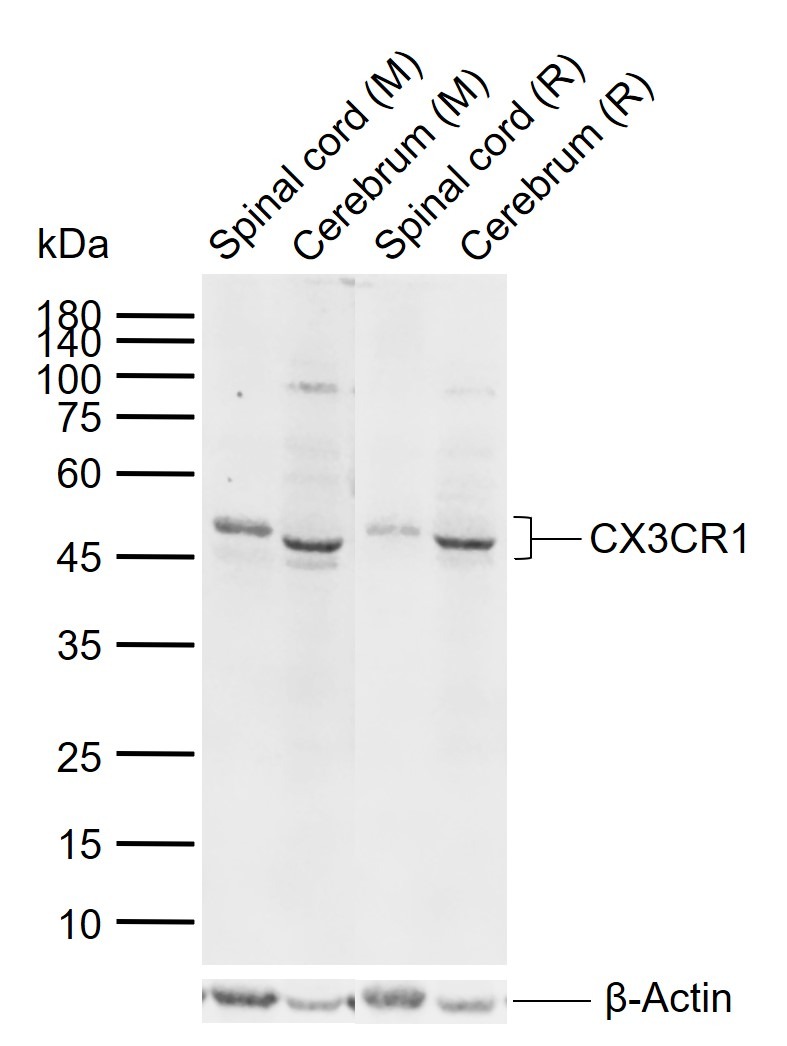 Anti-CX3CR1 Polyclonal Antibody