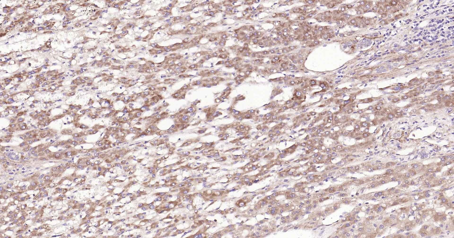 Anti-CYP7A1 Polyclonal Antibody 3