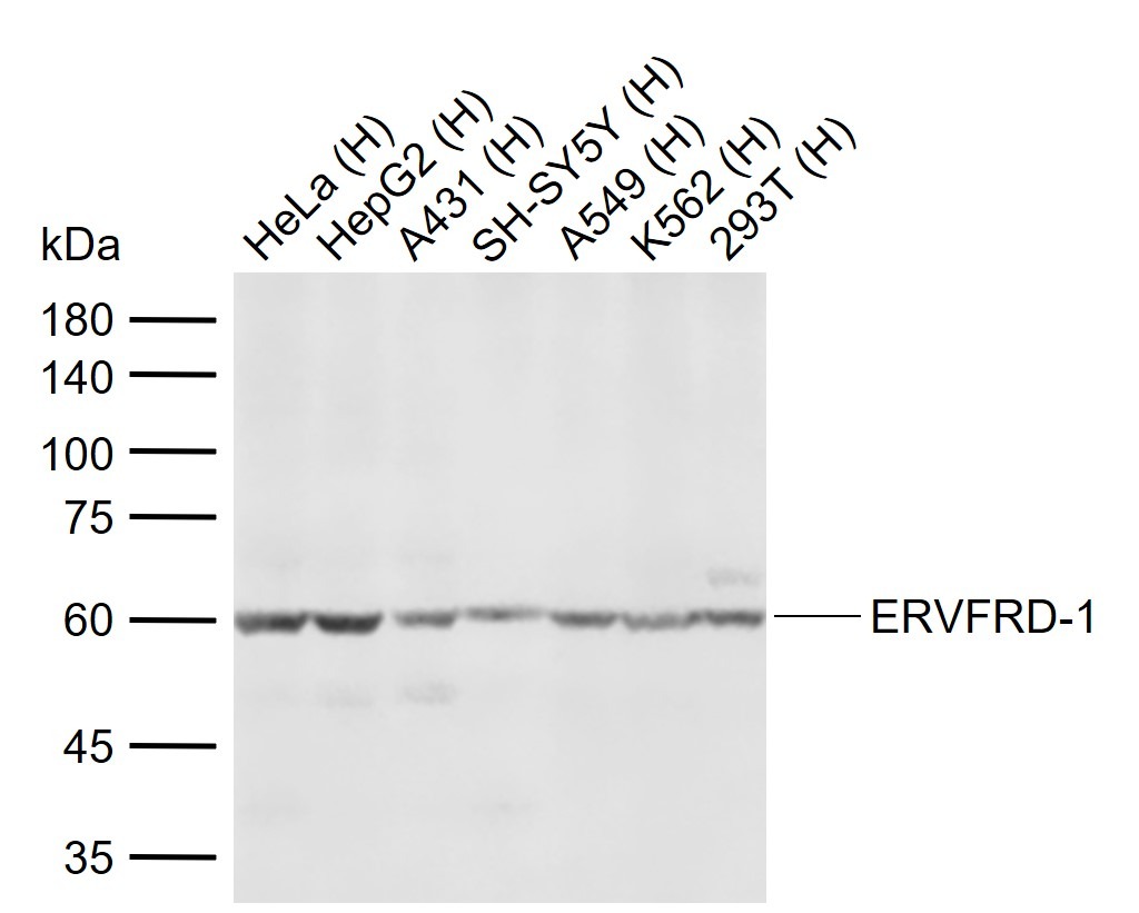 Anti-ERVFRD-1 Polyclonal Antibody