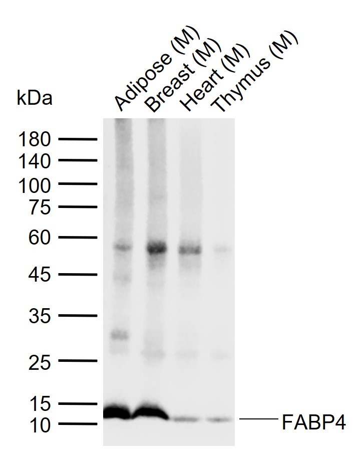 Anti-FABP4 Antibody (5W917)