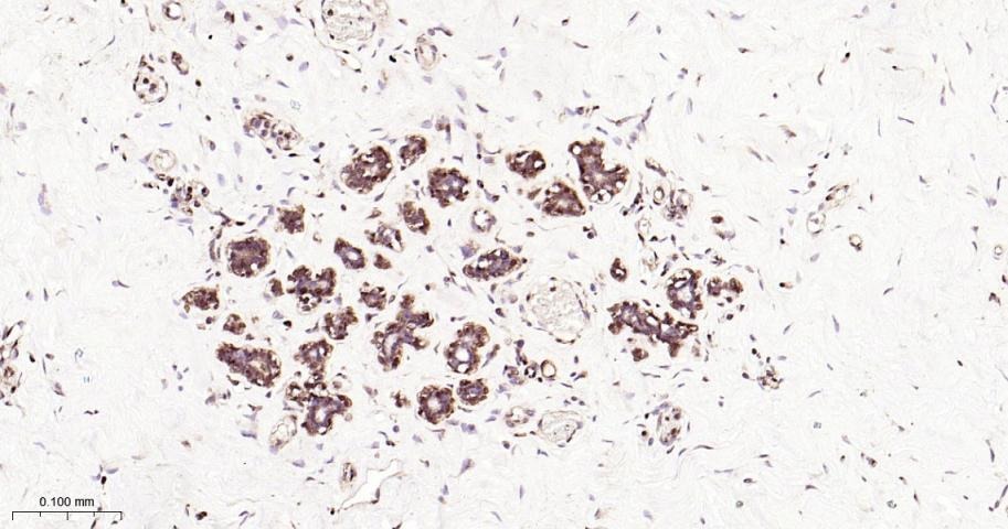 Anti-ERK1/2 Antibody (6Q27)