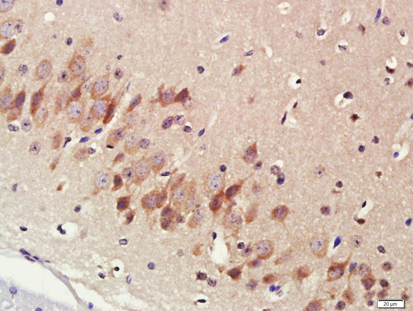 Anti-CYP17A1 Polyclonal Antibody