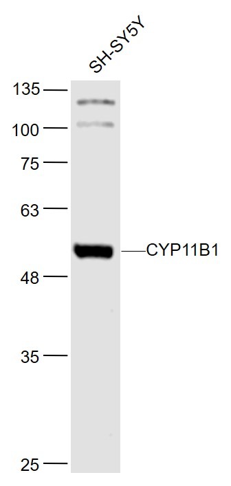 Anti-CYP11B1 Polyclonal Antibody