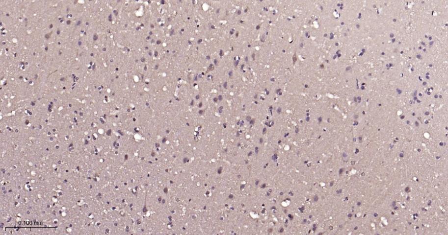 Anti-ERK1/2 Antibody (6Q27)