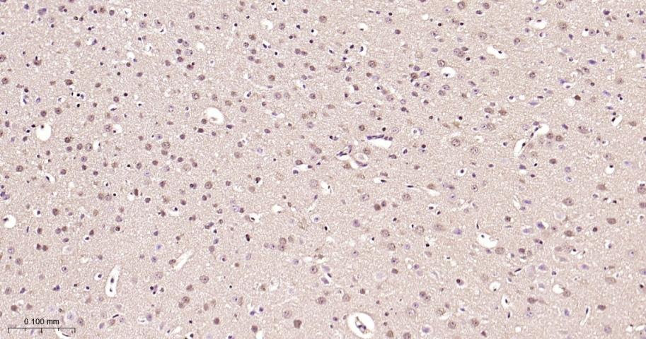 Anti-ERK1/2 Antibody (6Q27)