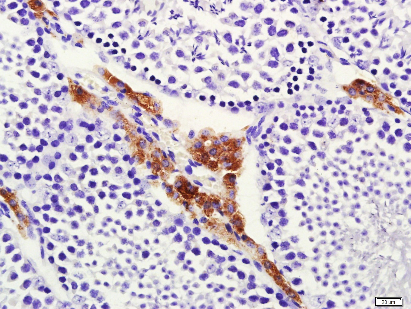 Anti-CYP17A1 Polyclonal Antibody