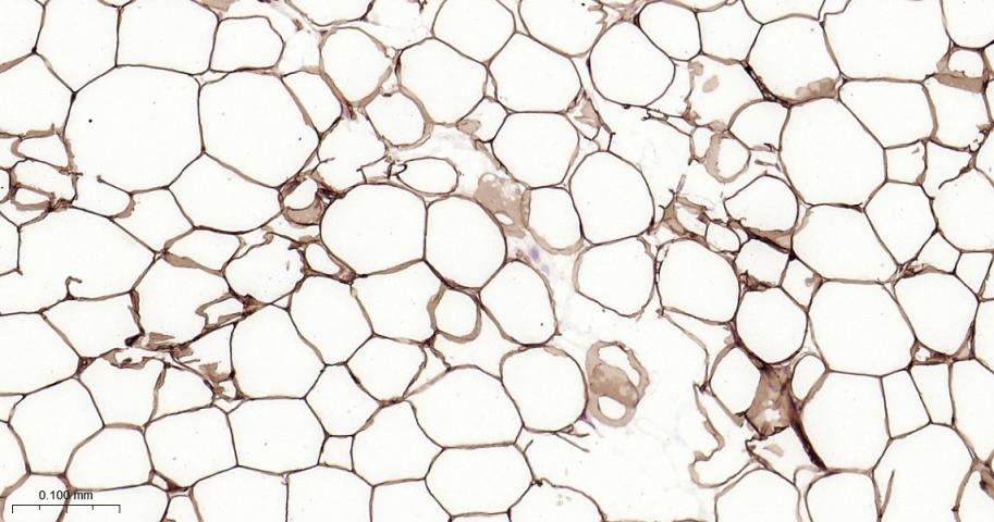 Anti-FABP4 Antibody (5W917)