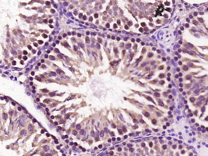 Anti-CYP1A1 Polyclonal Antibody