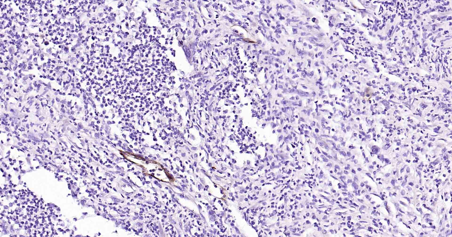 Anti-E-Selectin/CD62E Polyclonal Antibody