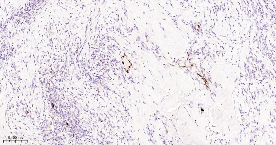 Anti-FABP4 Antibody (5W917)
