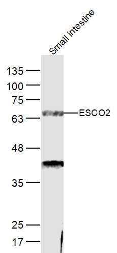 Anti-ESCO2 Polyclonal Antibody