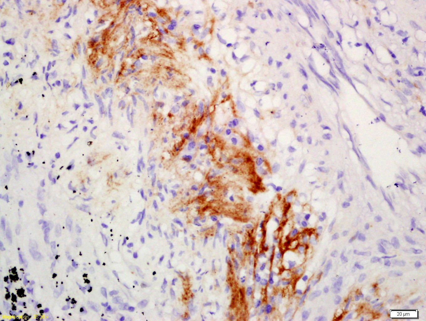 Anti-C1QA Polyclonal Antibody