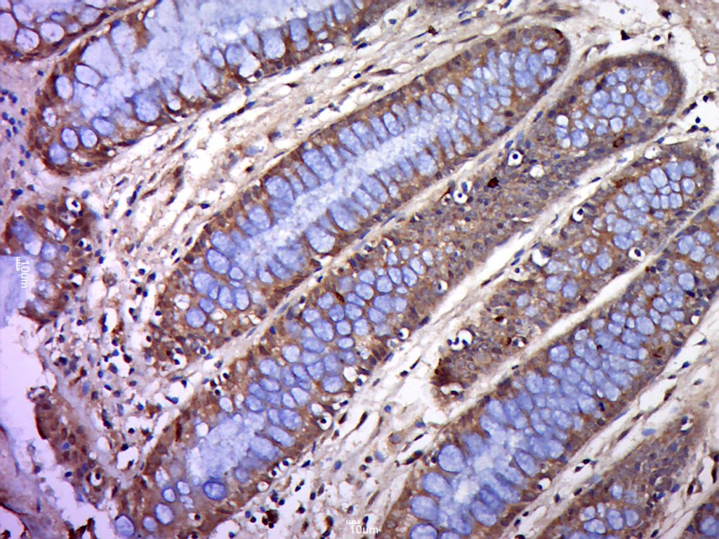 Anti-BTN2A1 Polyclonal Antibody