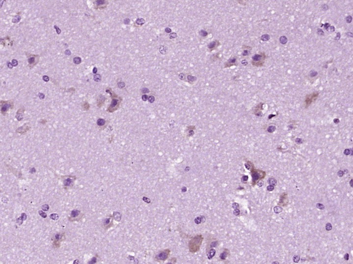 Anti-C1QA Polyclonal Antibody
