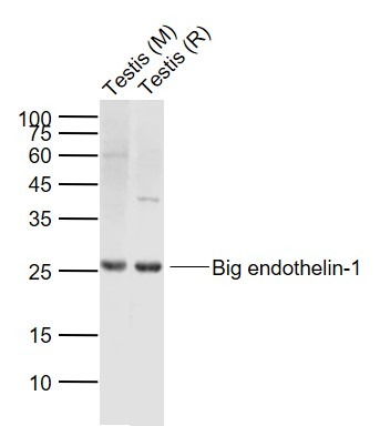 Anti-Endothelin-1/EDN1 Polyclonal Antibody