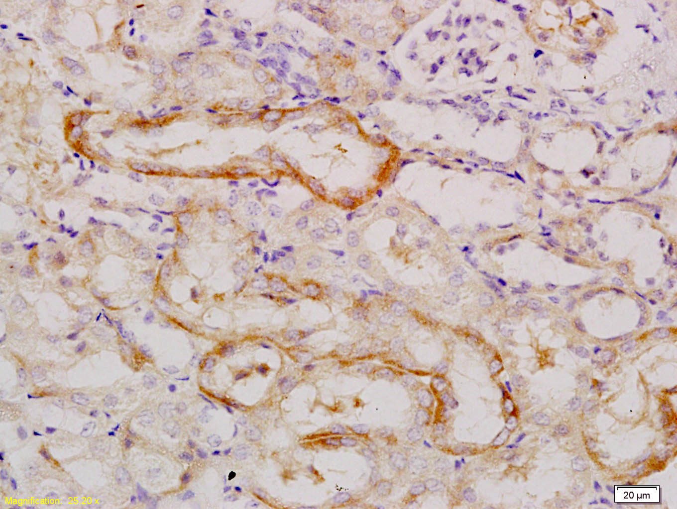 Anti-E-Cadherin/Cadherin-1 Polyclonal Antibody 2