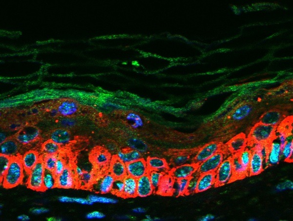 Anti-CXCL16 Polyclonal Antibody
