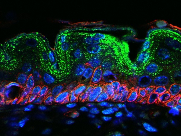 Anti-Eotaxin/CCL11 Polyclonal Antibody