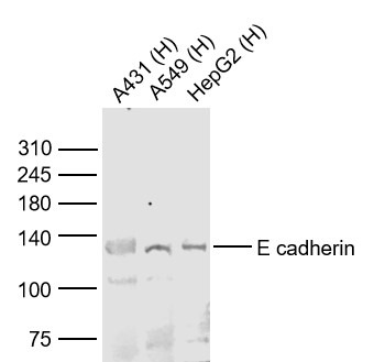 Anti-E-Cadherin/Cadherin-1 Polyclonal Antibody