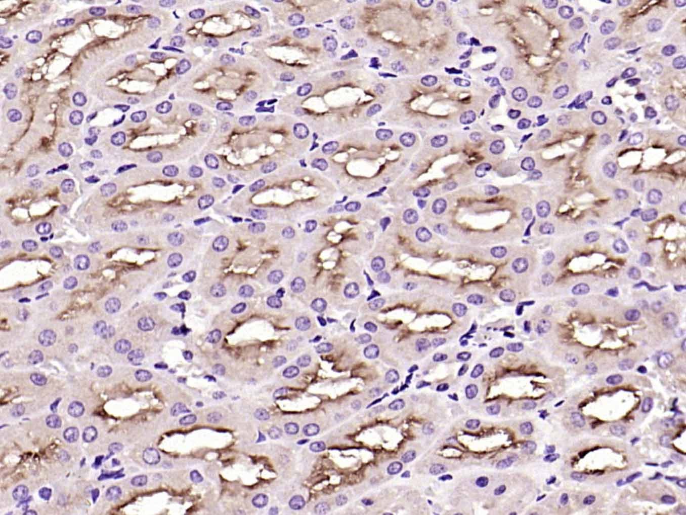 Anti-Endothelin-1/EDN1 Polyclonal Antibody 2