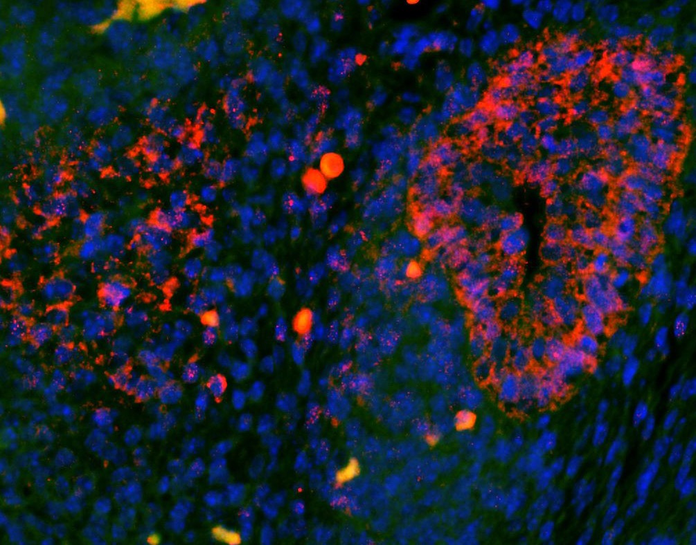 Anti-EpCAM Polyclonal Antibody