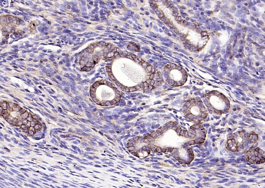 Anti-EpCAM Polyclonal Antibody 2