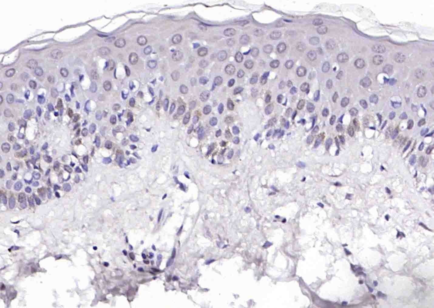 Anti-EP300 Polyclonal Antibody
