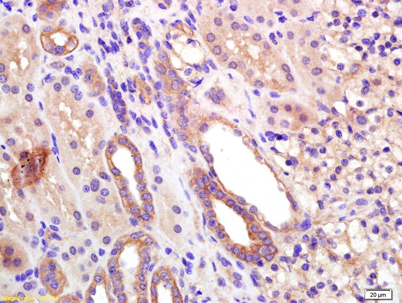 Anti-EDG3 Polyclonal Antibody