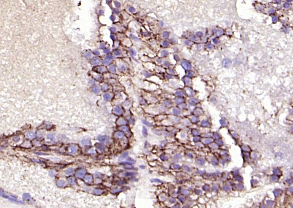 Anti-EpCAM Polyclonal Antibody 2
