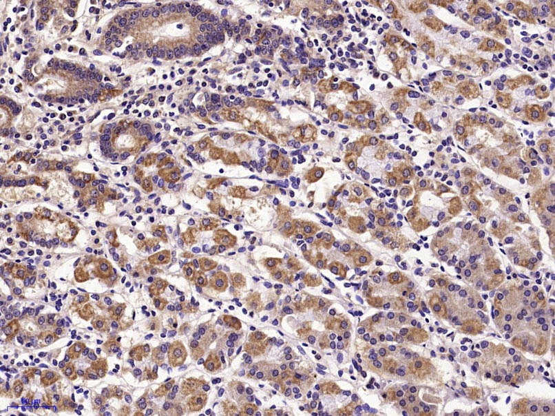 Anti-E-Cadherin/Cadherin-1 Polyclonal Antibody
