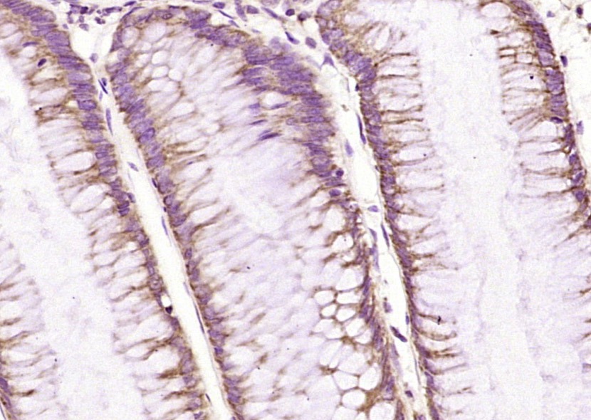 Anti-EpCAM Polyclonal Antibody