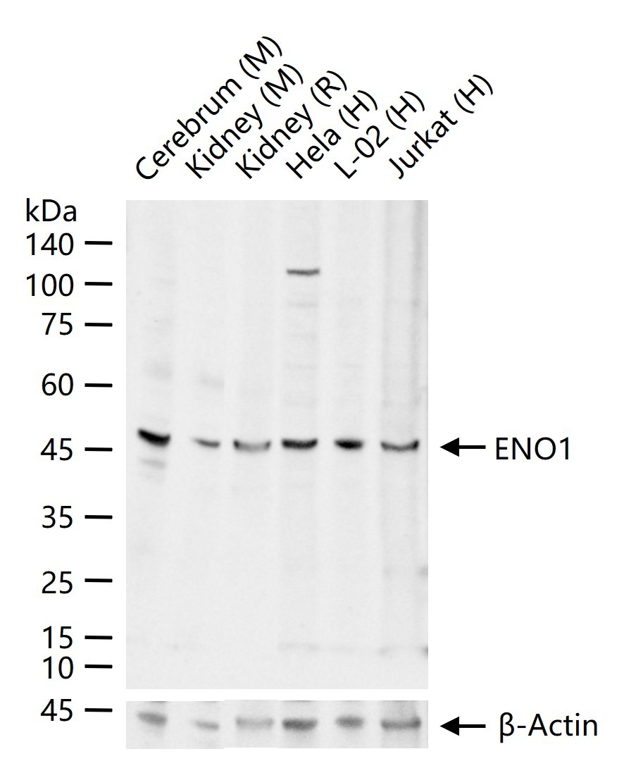 Anti-ENO1 Polyclonal Antibody