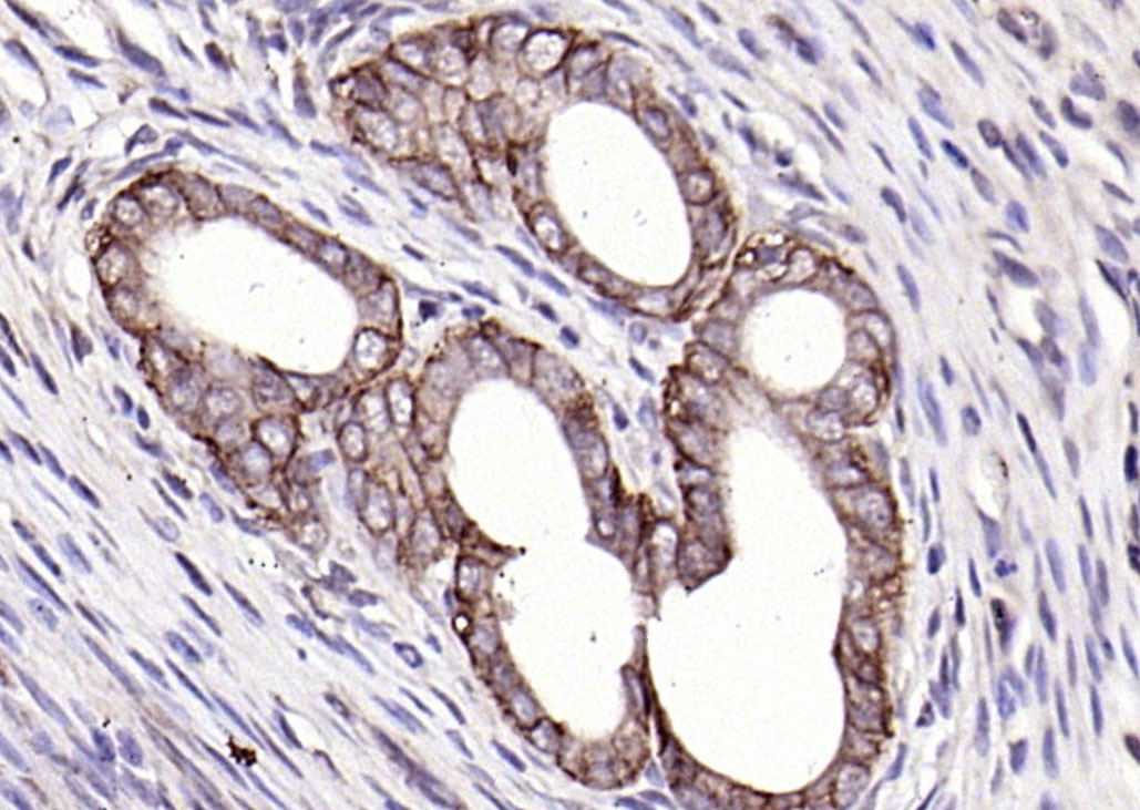 Anti-EpCAM Polyclonal Antibody 2