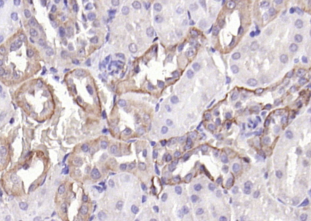 Anti-EpCAM Polyclonal Antibody 2