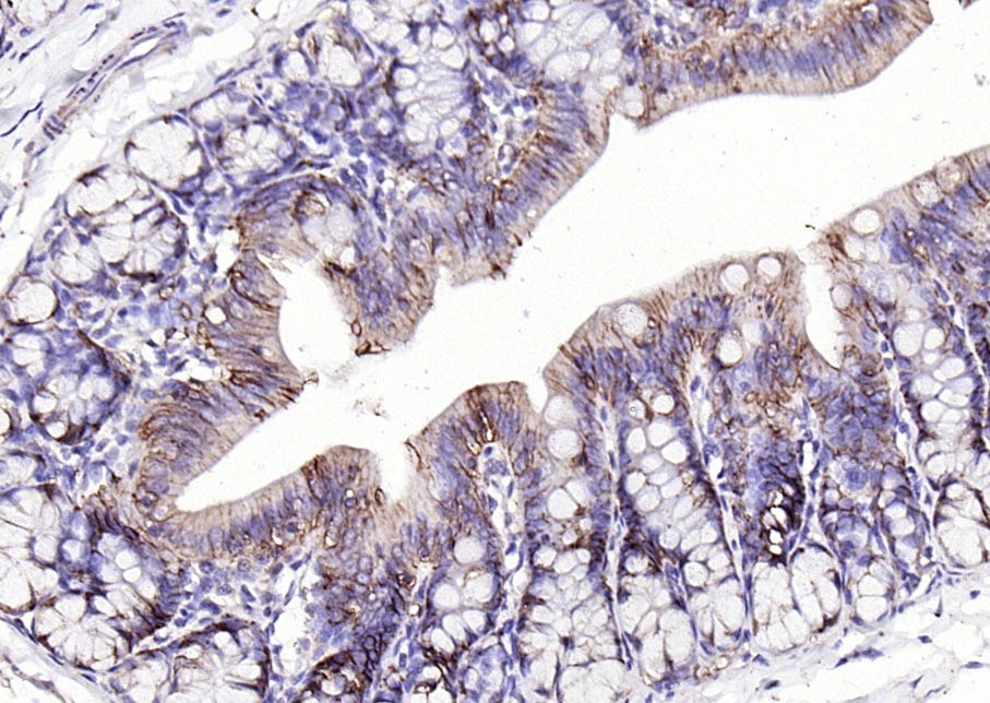 Anti-EpCAM Polyclonal Antibody 2