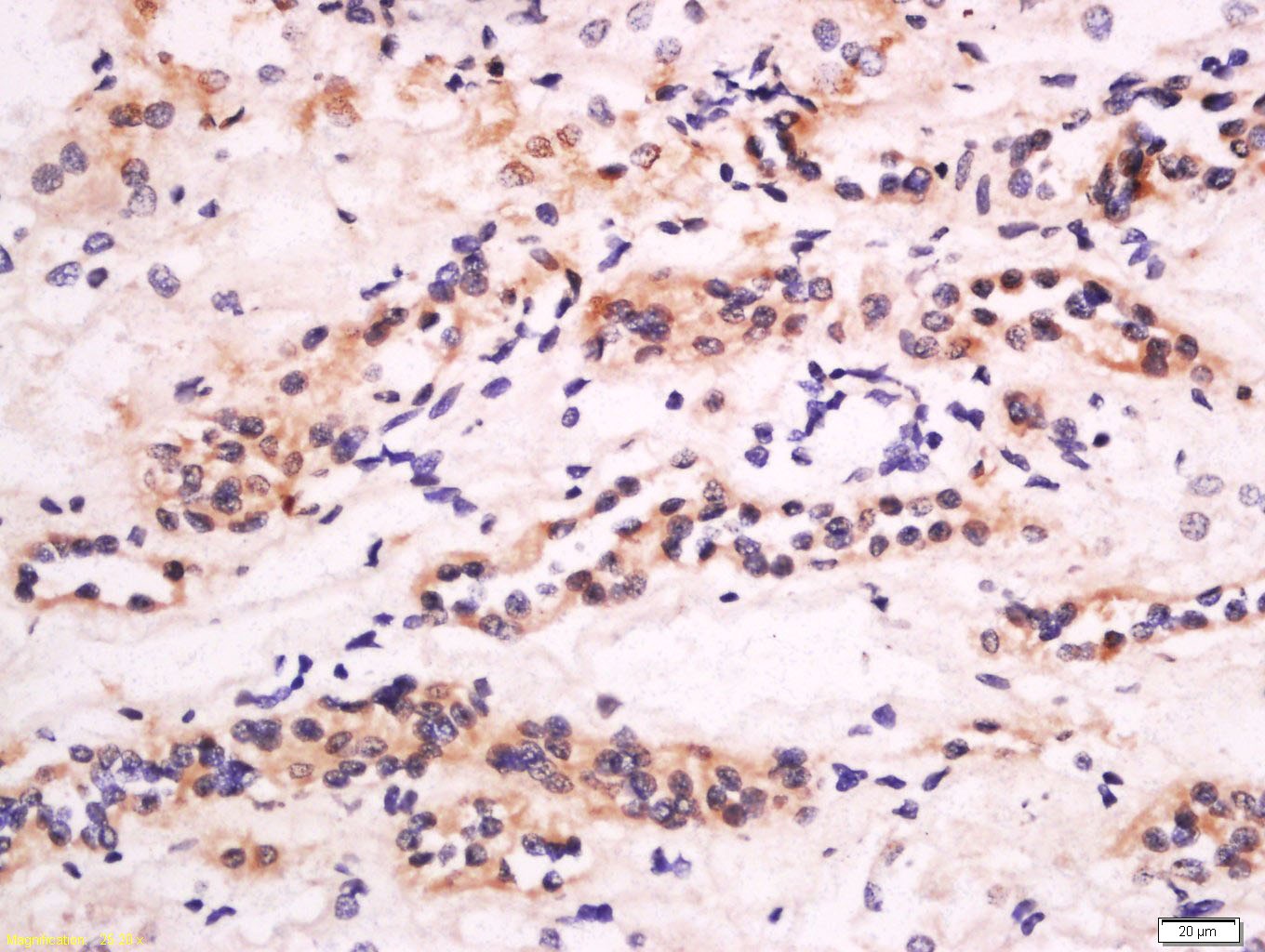 Anti-CXCL14 Polyclonal Antibody