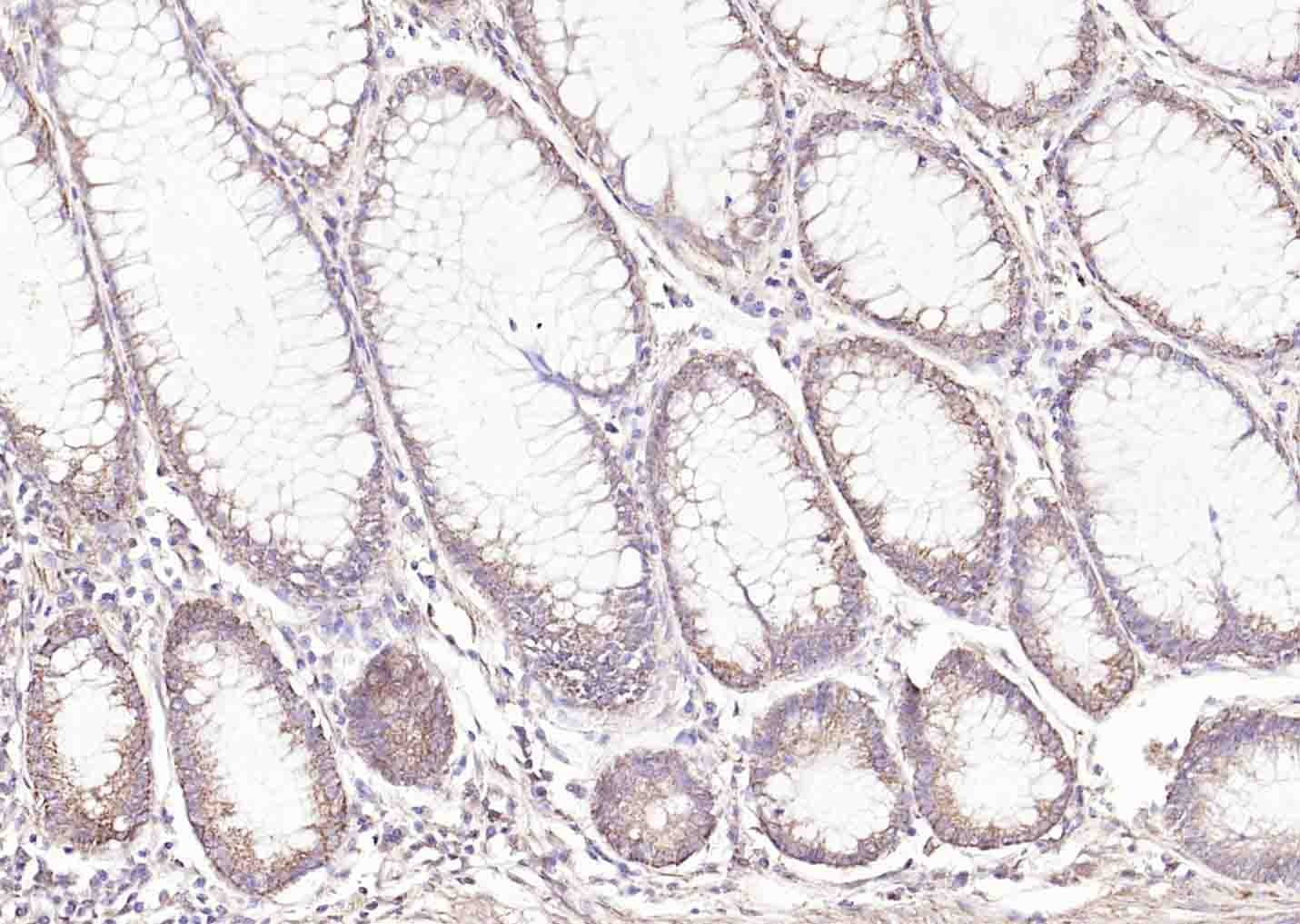 Anti-E-Cadherin/Cadherin-1 Polyclonal Antibody