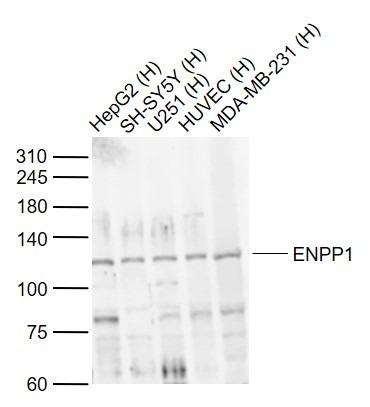 Anti-ENPP1 Polyclonal Antibody